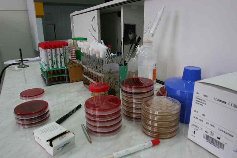 Unde au fost puse în vânzare autoteste pentru depistarea rapidă a HIV