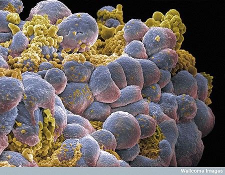 Decarbonizarea atmosferei terestre
