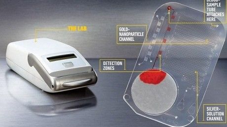 Cardul care detectează în 15 minute virusul HIV şi sifilisul