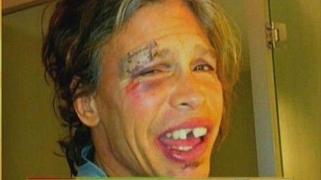 Steven Tyler, de nerecunoscut, după ce s-a accidentat în baie