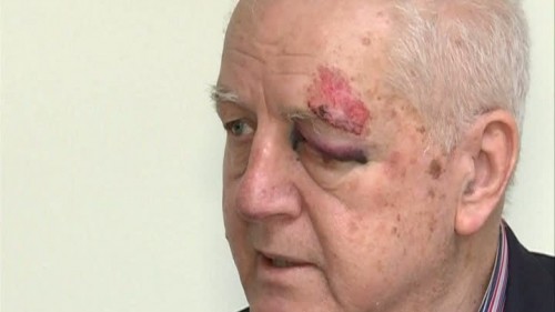 Jean Pădureanu, bătut şi tâlhărit în Bucureşti