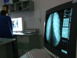 radiografie, radioterapie, cancer