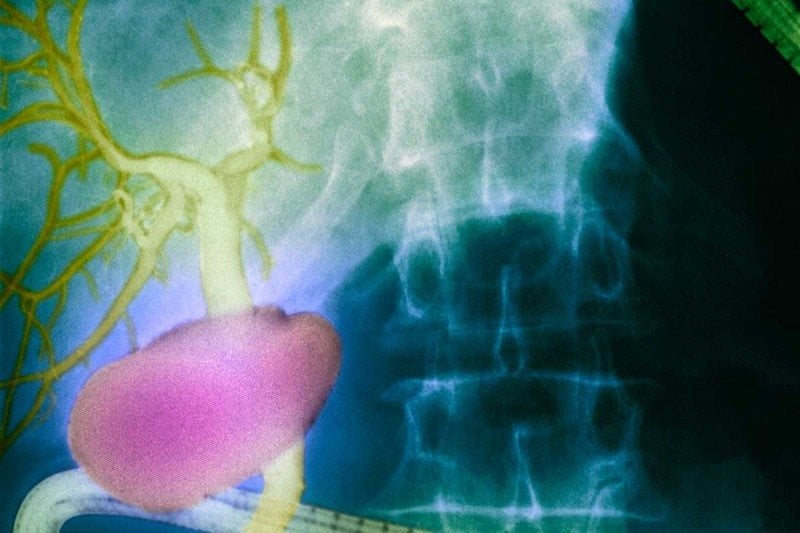 Un organ uman nou descoperit poate ajuta la descifrarea răspândirii cancerului