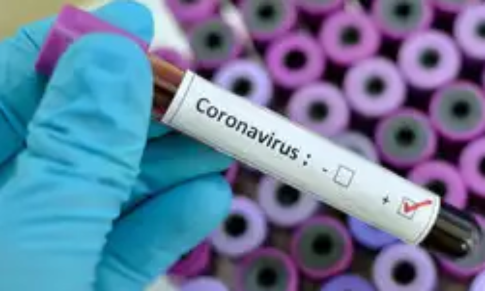https://www.cotidianul.ro/wp-content/uploads/2020/03/10/coronavirus-1-1000x600.png