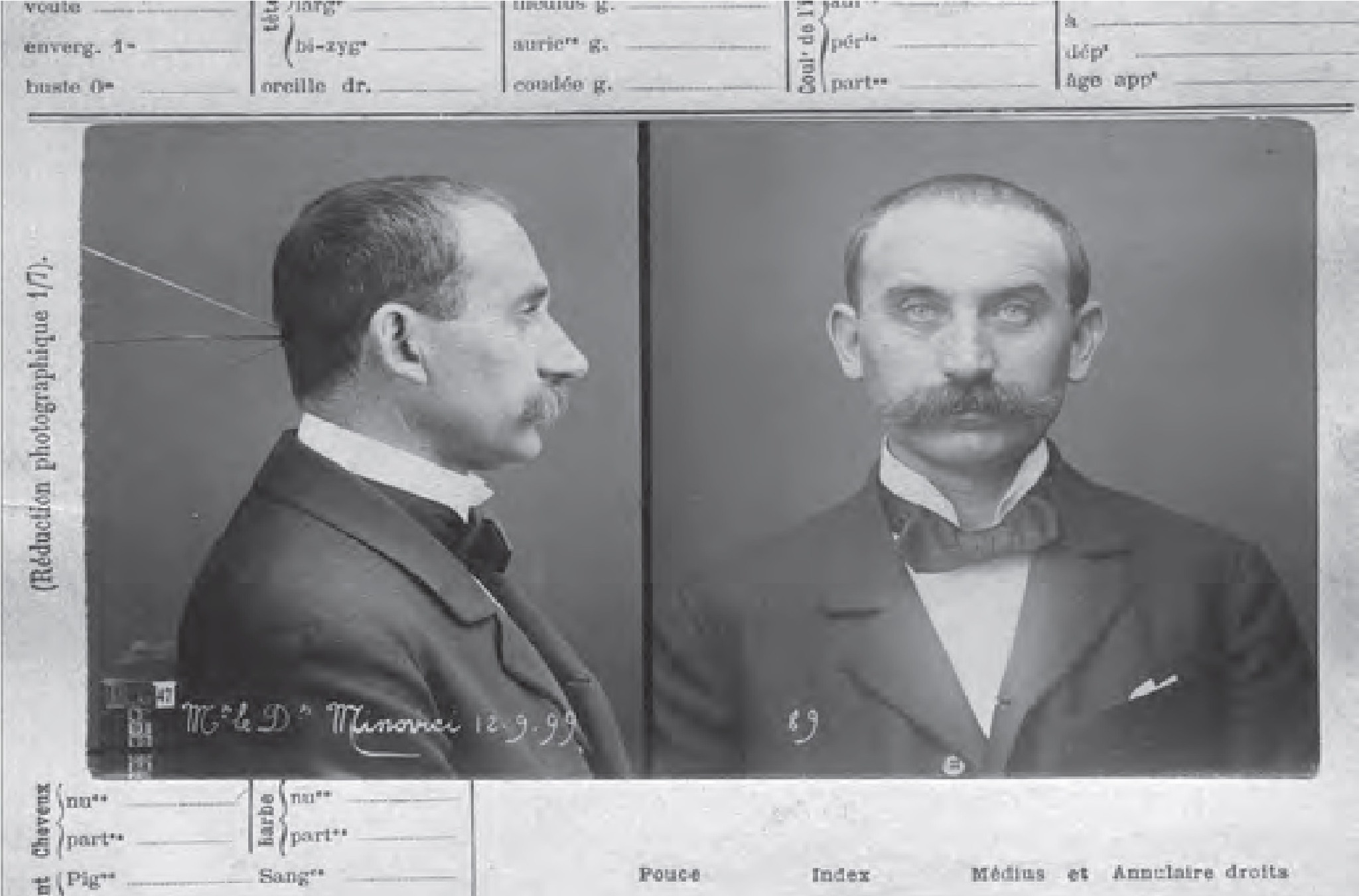 Aplicarea metodei Bertillon în cadrul Prefecturii Poliției București