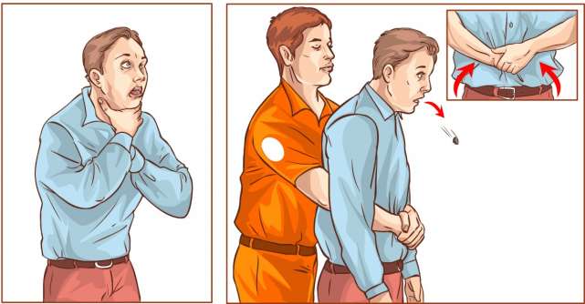 Medic: Manevra Heimlich trebuie învăţată şi exersată în școli