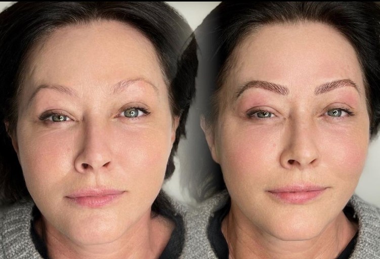 Shannen Doherty are cancer la creier