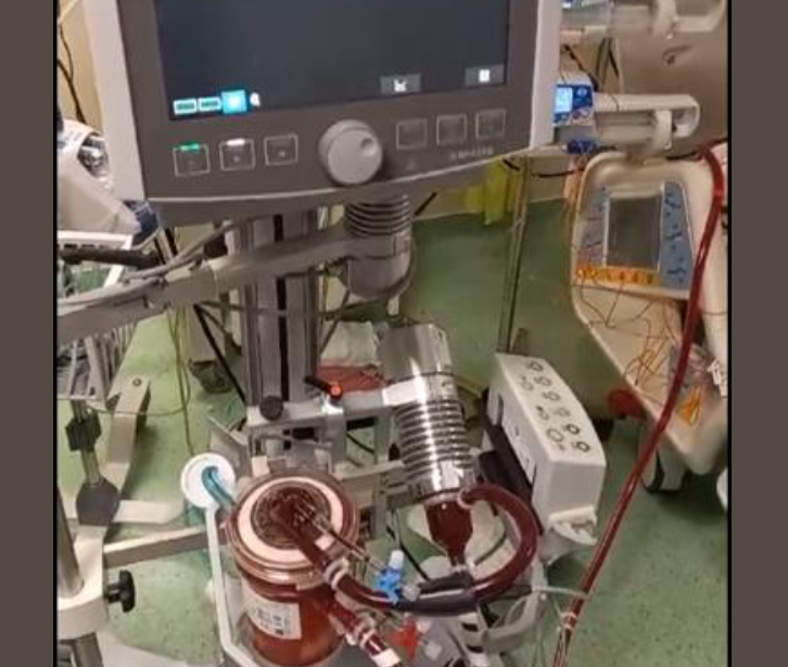 Salvați cu ajutorul “plămânului artificial”