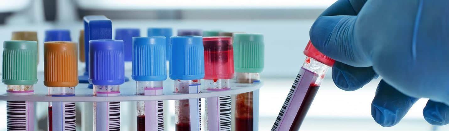 Teste gratuite în București pentru HIV și hepatită