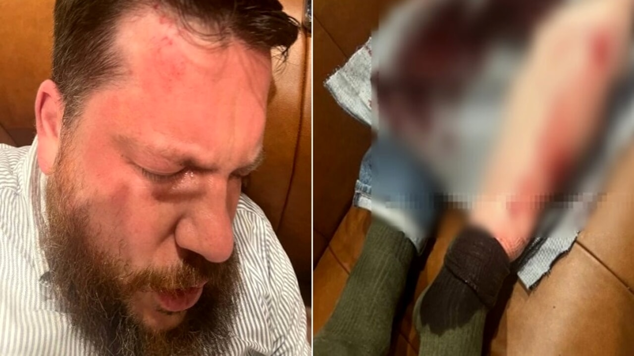 Apropiat al lui Navalnîi bătut cu ciocanul: Ipoteza serviciilor secrete