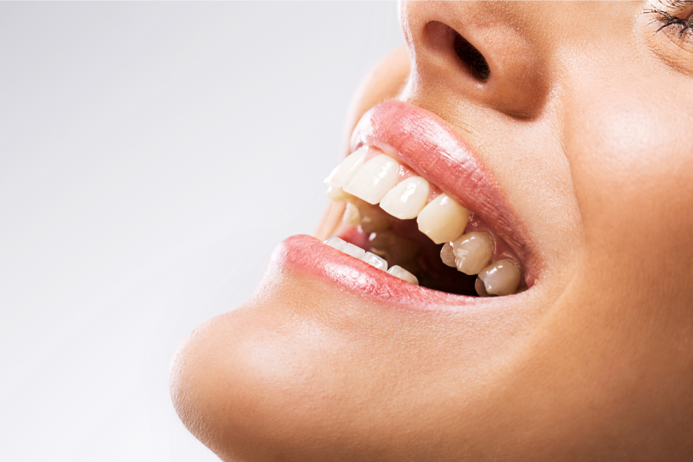Estetica dentară: secretul unui zâmbet strălucitor