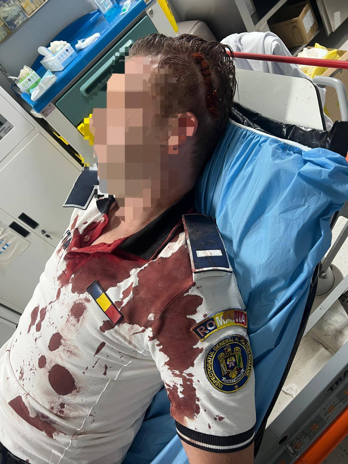 Polițist la spital după ce a fost lovit cu bâta