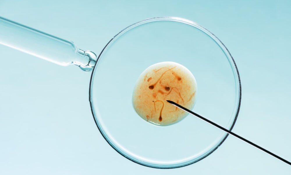 Premieră medicală: embrioni umani obținuți cu ajutorul AI