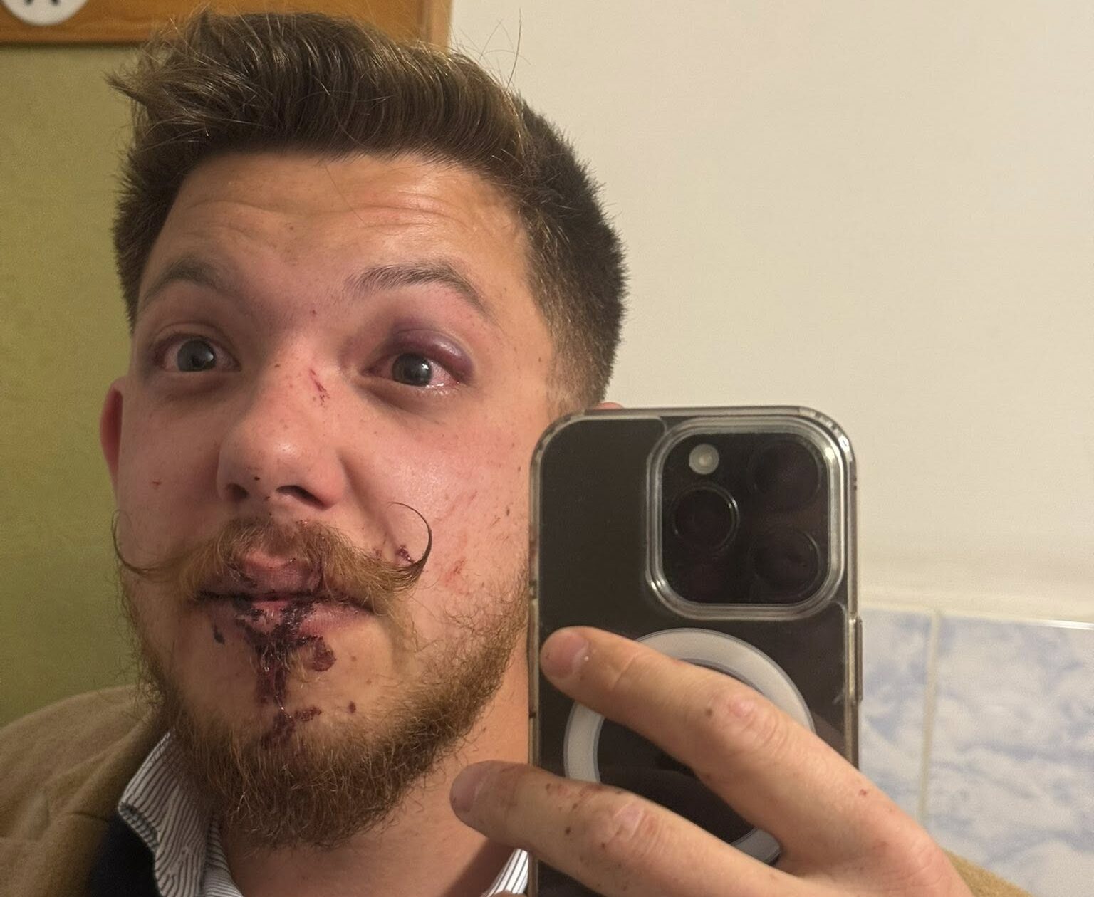 Oficiali ai clubului Sepsi, implicați într-o bătaie pe stradă