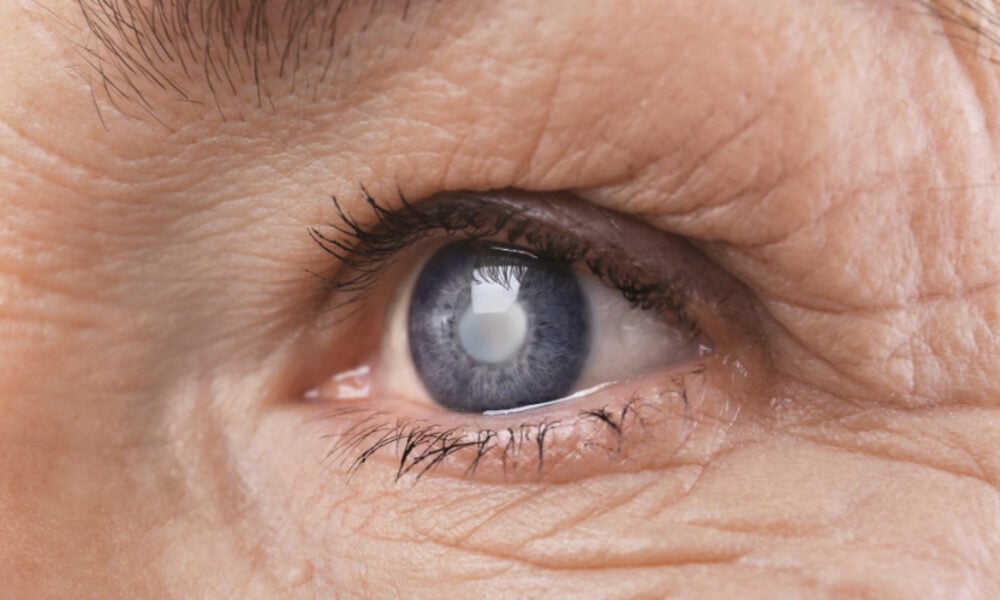 Cataracta, cea mai frecventă operație în UE. România, la coada clasamentului