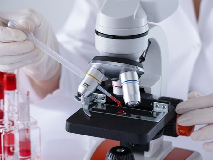 Cancer de piele tratat fără bisturiu